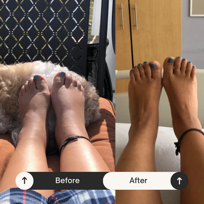 FeetCircu: Comfortable Circulation Socks